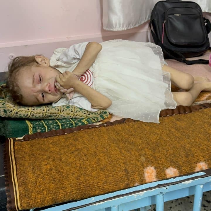malnutrition bande de gaza gaza hopital khan younis enfant