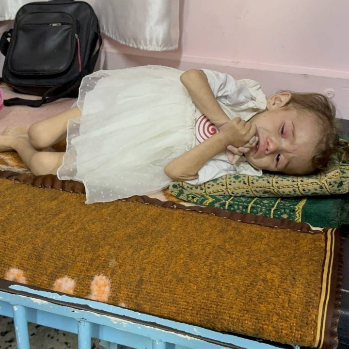 malnutrition bande de gaza gaza hopital khan younis enfant