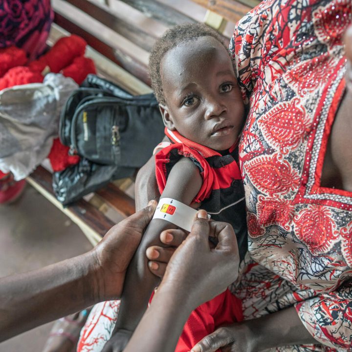 Examen nutritionnel d'un enfant à la clinique de Kimu, à Juba, au Soudan du Sud. © UNICEF/UNI632024/Naftalin